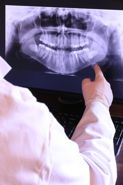 Best Emergency Tooth Extraction  in Lyndhurst, VA