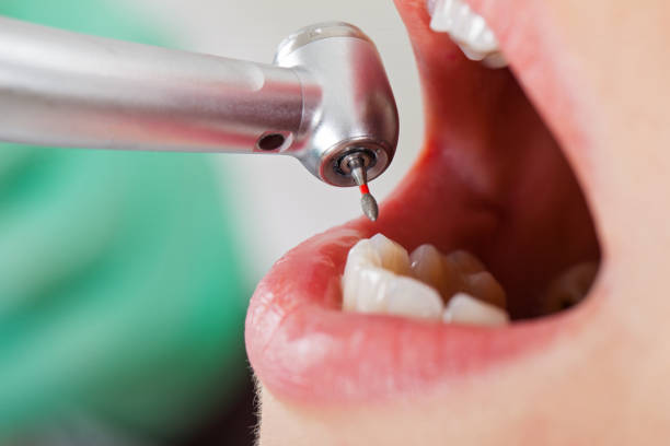 Best Tooth Pain Emergency Relief  in Lyndhurst, VA